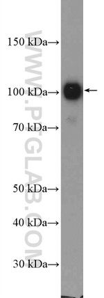 AP2B1 Antibody in Western Blot (WB)