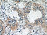 TK1 Antibody in Immunohistochemistry (Paraffin) (IHC (P))