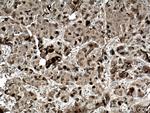 TK1 Antibody in Immunohistochemistry (Paraffin) (IHC (P))