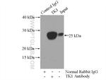 TK1 Antibody in Immunoprecipitation (IP)