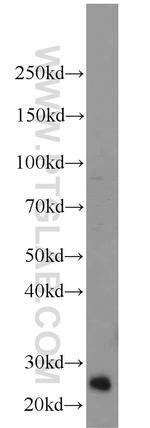 TK1 Antibody in Western Blot (WB)