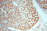 CLPP Antibody in Immunohistochemistry (Paraffin) (IHC (P))