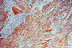 HSPB7 Antibody in Immunohistochemistry (Paraffin) (IHC (P))