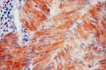 HSPB7 Antibody in Immunohistochemistry (Paraffin) (IHC (P))