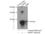 HSPB7 Antibody in Immunoprecipitation (IP)