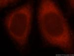 PIP5K1A Antibody in Immunocytochemistry (ICC/IF)