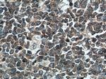 PIP5K1A Antibody in Immunohistochemistry (Paraffin) (IHC (P))