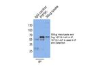 PIP5K1A Antibody in Immunoprecipitation (IP)