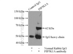 PIP5K1A Antibody in Immunoprecipitation (IP)