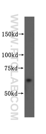 PIP5K1A Antibody in Western Blot (WB)