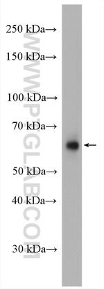 PIP5K1A Antibody in Western Blot (WB)