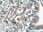 MIA Antibody in Immunohistochemistry (Paraffin) (IHC (P))