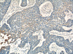 MIA Antibody in Immunohistochemistry (Paraffin) (IHC (P))