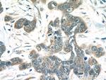 MIA Antibody in Immunohistochemistry (Paraffin) (IHC (P))