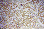 TRIM14 Antibody in Immunohistochemistry (Paraffin) (IHC (P))