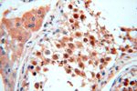 TRBP Antibody in Immunohistochemistry (Paraffin) (IHC (P))