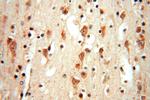 TRBP Antibody in Immunohistochemistry (Paraffin) (IHC (P))