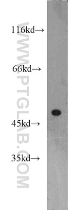 TRBP Antibody in Western Blot (WB)