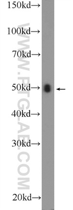 TRBP Antibody in Western Blot (WB)