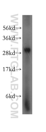 LHPP Antibody in Western Blot (WB)