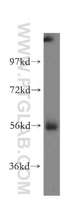 MGAT2 Antibody in Western Blot (WB)