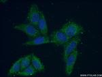 VARS2 Antibody in Immunocytochemistry (ICC/IF)