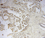 VARS2 Antibody in Immunohistochemistry (Paraffin) (IHC (P))