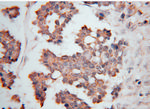 VARS2 Antibody in Immunohistochemistry (Paraffin) (IHC (P))