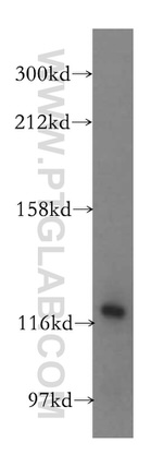 VARS2 Antibody in Western Blot (WB)