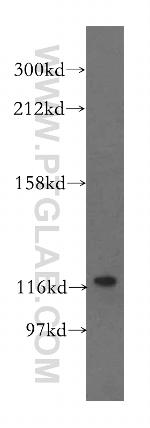 VARS2 Antibody in Western Blot (WB)