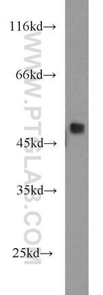 RBM41 Antibody in Western Blot (WB)