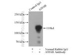 ATF6B Antibody in Immunoprecipitation (IP)