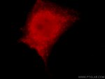 PKM1 Antibody in Immunocytochemistry (ICC/IF)