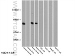 PKM1 Antibody in Western Blot (WB)