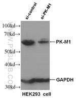 PKM1 Antibody in Western Blot (WB)