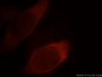 PKM2 Antibody in Immunocytochemistry (ICC/IF)