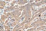 PKM2 Antibody in Immunohistochemistry (Paraffin) (IHC (P))