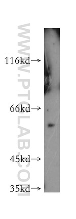 PKM2 Antibody in Western Blot (WB)