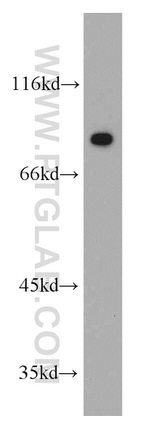 PKM2 Antibody in Western Blot (WB)