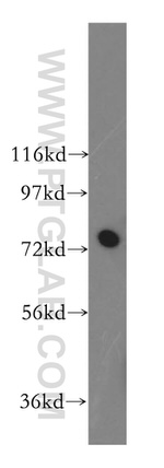 GARS Antibody in Western Blot (WB)