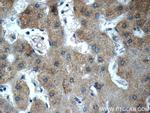 Fibrinogen gamma chain Antibody in Immunohistochemistry (Paraffin) (IHC (P))