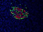 Insulin Antibody in Immunocytochemistry (ICC/IF)