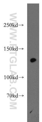 SF3A1 Antibody in Western Blot (WB)