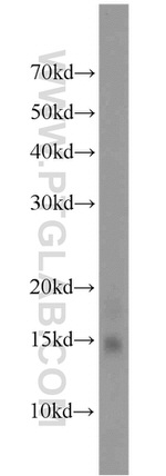 FABP4 Antibody in Western Blot (WB)