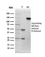 Aromatase/Cytochrome P450 (CYP19A1) Antibody in SDS-PAGE (SDS-PAGE)