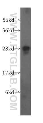 FKBP14 Antibody in Western Blot (WB)