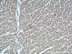 RAB11A/B Antibody in Immunohistochemistry (Paraffin) (IHC (P))