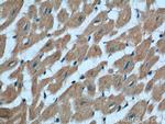 RAB11A/B Antibody in Immunohistochemistry (Paraffin) (IHC (P))