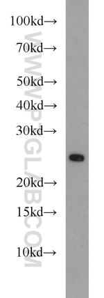 RAB11A/B Antibody in Western Blot (WB)