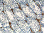 ALDH1A1 Antibody in Immunohistochemistry (Paraffin) (IHC (P))